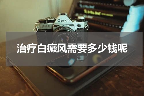 治疗白癜风需要多少钱呢