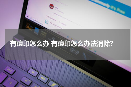 有痘印怎么办 有痘印怎么办法消除?