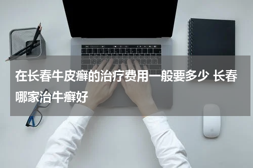 在长春牛皮癣的治疗费用一般要多少 长春哪家治牛癣好