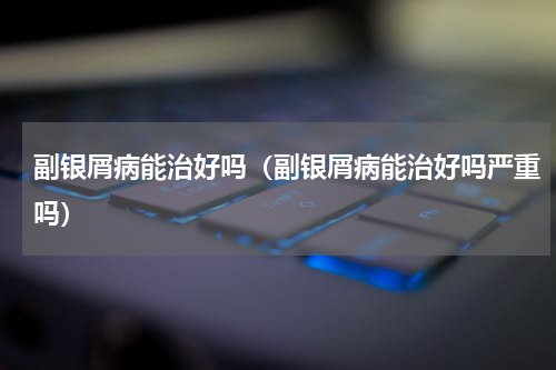 副银屑病能治好吗（副银屑病能治好吗严重吗）