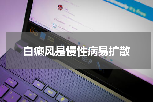 白癜风是慢性病易扩散