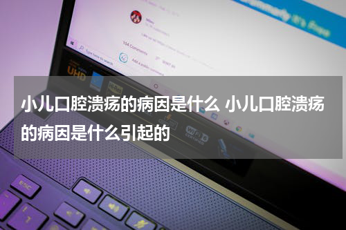 小儿口腔溃疡的病因是什么 小儿口腔溃疡的病因是什么引起的