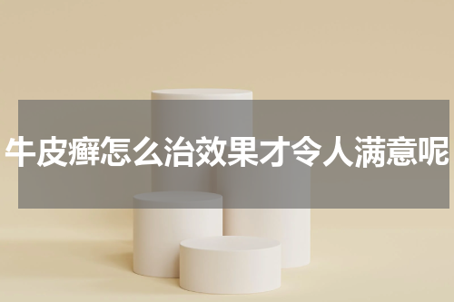 牛皮癣怎么治效果才令人满意呢