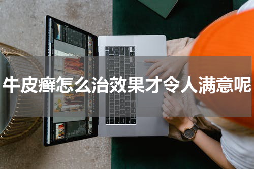 牛皮癣怎么治效果才令人满意呢