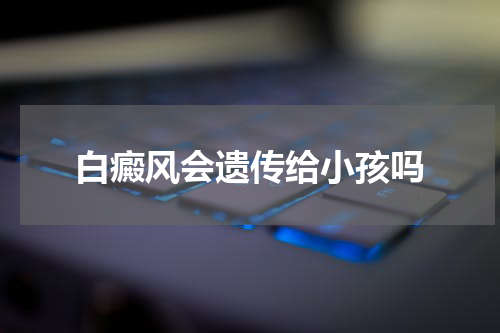 白癜风会遗传给小孩吗