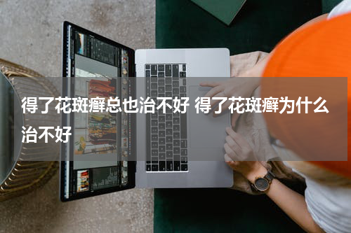 得了花斑癣总也治不好 得了花斑癣为什么治不好
