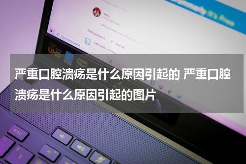 严重口腔溃疡是什么原因引起的 严重口腔溃疡是什么原因引起的图片