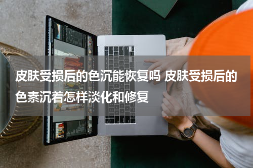 皮肤受损后的色沉能恢复吗 皮肤受损后的色素沉着怎样淡化和修复