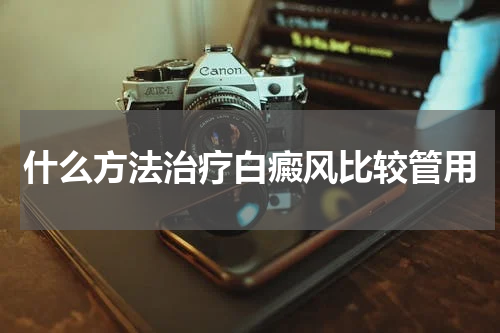 什么方法治疗白癜风比较管用