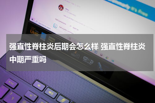 强直性脊柱炎后期会怎么样 强直性脊柱炎中期严重吗