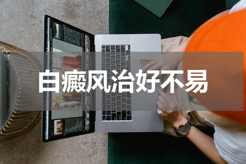 白癜风治好不易