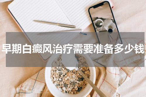 早期白癜风治疗需要准备多少钱