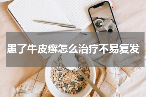 患了牛皮癣怎么治疗不易复发