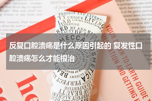反复口腔溃疡是什么原因引起的 复发性口腔溃疡怎么才能根治