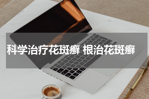 科学治疗花斑癣 根治花斑癣