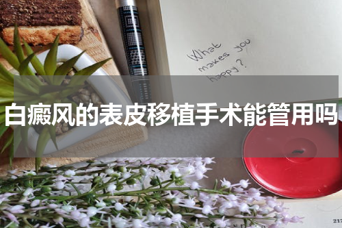 白癜风的表皮移植手术能管用吗