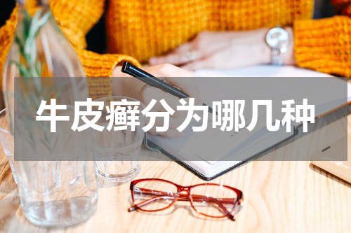 牛皮癣分为哪几种