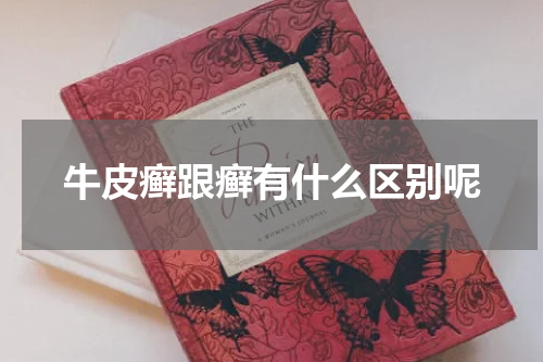 牛皮癣跟癣有什么区别呢