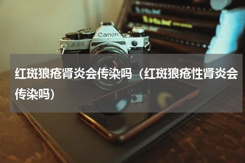 红斑狼疮肾炎会传染吗（红斑狼疮性肾炎会传染吗）