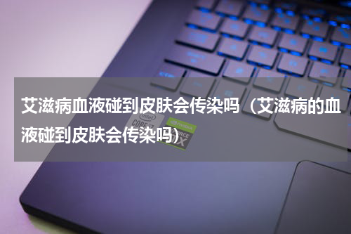 艾滋病血液碰到皮肤会传染吗（艾滋病的血液碰到皮肤会传染吗）