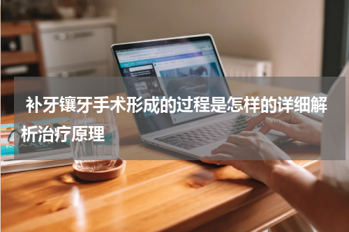  补牙镶牙手术形成的过程是怎样的详细解析治疗原理