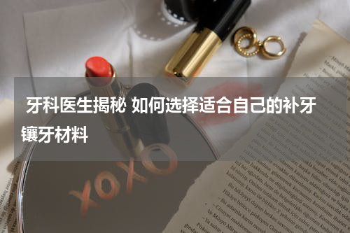  牙科医生揭秘 如何选择适合自己的补牙镶牙材料
