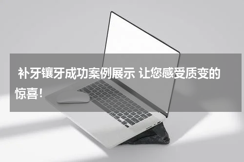  补牙镶牙成功案例展示 让您感受质变的惊喜！