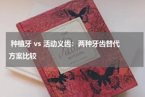  种植牙 vs 活动义齿：两种牙齿替代方案比较