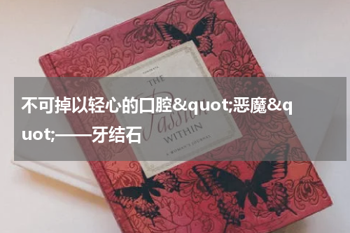 不可掉以轻心的口腔&quot;恶魔&quot;——牙结石
