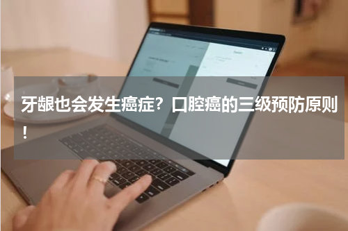 牙龈也会发生癌症？口腔癌的三级预防原则！